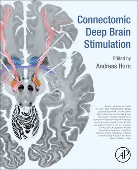 Horn |  Connectomic Deep Brain Stimulation | Buch |  Sack Fachmedien