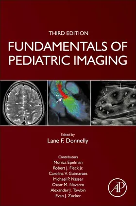 Donnelly |  Fundamentals of Pediatric Imaging | Buch |  Sack Fachmedien