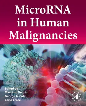 Negrini / Calin / Croce |  Microrna in Human Malignancies | Buch |  Sack Fachmedien