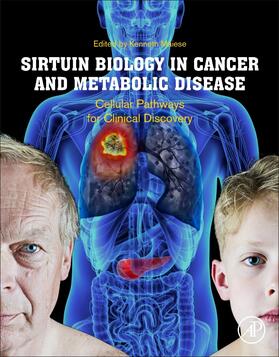 Maiese |  Sirtuin Biology in Cancer and Metabolic Disease | Buch |  Sack Fachmedien