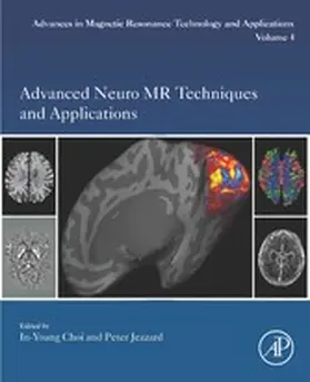 Choi / Jezzard |  Advanced Neuro MR Techniques and Applications | eBook | Sack Fachmedien