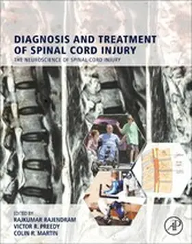 Rajendram AKC / Rajendram / R Martin RN |  Diagnosis and Treatment of Spinal Cord Injury | eBook | Sack Fachmedien