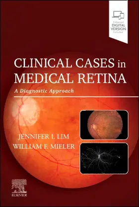 Lim / Mieler |  Clinical Cases in Medical Retina | Buch |  Sack Fachmedien