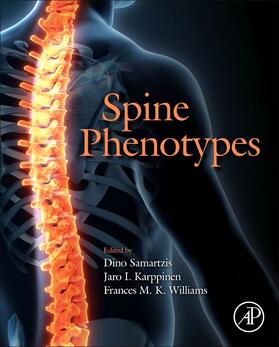 Samartzis / Karppinen / Williams |  Spine Phenotypes | Buch |  Sack Fachmedien