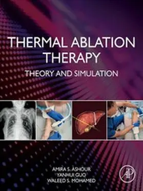 Ashour / Guo / Mohamed |  Thermal Ablation Therapy | eBook | Sack Fachmedien