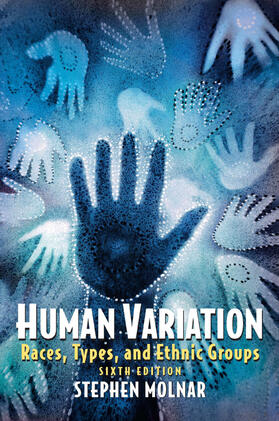 Molnar |  Human Variation | Buch |  Sack Fachmedien
