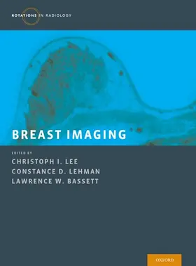 Lee / Lehman / Bassett |  Breast Imaging | Buch |  Sack Fachmedien