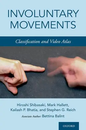 Shibasaki / Hallett / Bhatia |  Involuntary Movements | Buch |  Sack Fachmedien