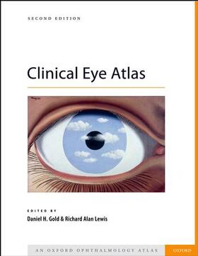 Gold / Lewis |  Clinical Eye Atlas | Buch |  Sack Fachmedien