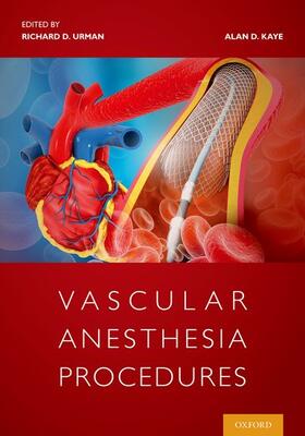 Urman / Kaye |  Vascular Anesthesia Procedures | Buch |  Sack Fachmedien