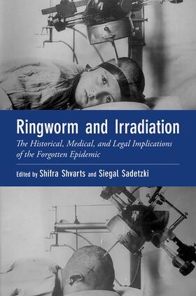 Shvarts / Sadetzki |  Ringworm and Irradiation | Buch |  Sack Fachmedien