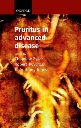 Jones / Zylicz / Twycross |  Pruritus in Advanced Disease | Buch |  Sack Fachmedien