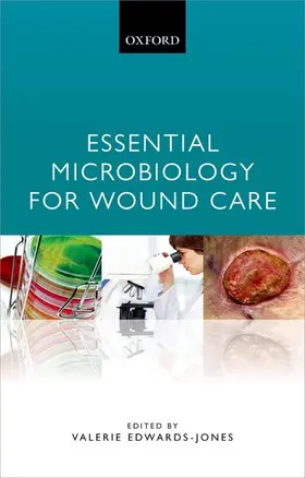 Edwards-Jones |  Essential Microbiology for Wound Care | Buch |  Sack Fachmedien