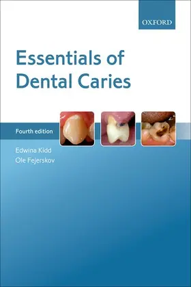 Kidd / Fejerskov |  Essentials of Dental Caries | Buch |  Sack Fachmedien