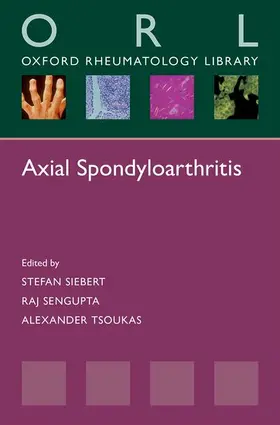 Siebert / Sengupta / Tsoukas |  Axial Spondyloarthritis | Buch |  Sack Fachmedien