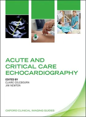 Colebourn / Newton |  Acute and Critical Care Echocardiography | Buch |  Sack Fachmedien