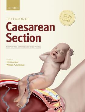 Jauniaux / Grobman |  Textbook of Caesarean Section | Buch |  Sack Fachmedien