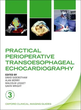 Sidebotham / Merry / Legget |  Practical Perioperative Transoesophageal Echocardiography | Buch |  Sack Fachmedien