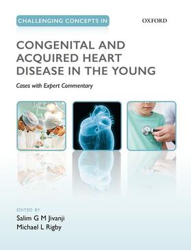 Jivanji / Rigby |  Challenging Concepts in Congenital and Acquired Heart Disease in the Young | Buch |  Sack Fachmedien