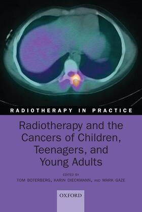 Boterberg / Dieckmann / Gaze |  Radiotherapy and the Cancers of Children, Teenagers and Young Adults | Buch |  Sack Fachmedien