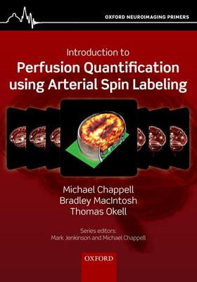 Chappell / MacIntosh / Okell |  Introduction to Perfusion Quantification Using Arterial Spin Labelling | Buch |  Sack Fachmedien
