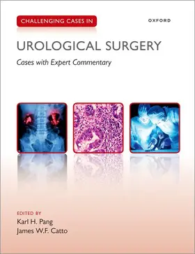 Pang / Catto |  Challenging Cases in Urological Surgery | Buch |  Sack Fachmedien