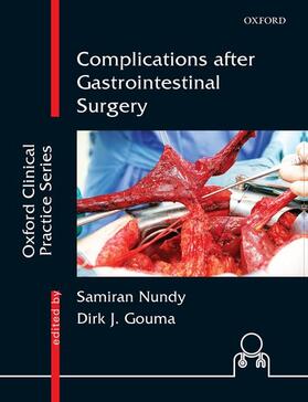 Nundy / Gouma |  Complications After Gastrointestinal Surgery | Buch |  Sack Fachmedien