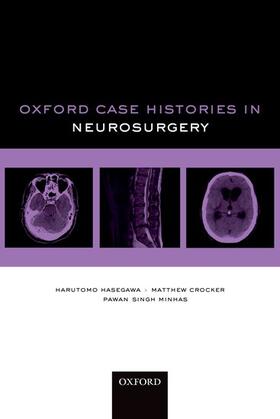 Hasegawa / Crocker / Singh Minhas |  Oxford Case Histories in Neurosurgery | Buch |  Sack Fachmedien