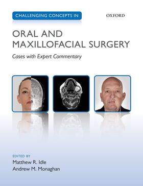 Idle / Monaghan |  Challenging Concepts in Oral and Maxillofacial Surgery | Buch |  Sack Fachmedien