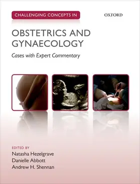 Hezelgrave / Abbott / Shennan |  Challenging Concepts in Obstetrics and Gynaecology | Buch |  Sack Fachmedien