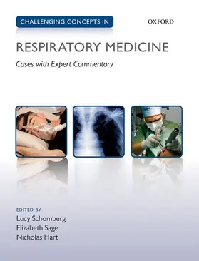 Schomberg / Sage / Hart |  Challenging Concepts in Respiratory Medicine | Buch |  Sack Fachmedien