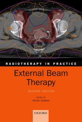 Hoskin |  External Beam Therapy | Buch |  Sack Fachmedien