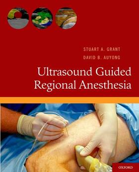 Grant / Auyoung |  Ultrasound Guided Regional Anesthesia | Buch |  Sack Fachmedien