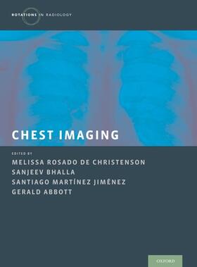 Rosado de Christenson / Bhalla / Abbott |  Chest Imaging | Buch |  Sack Fachmedien