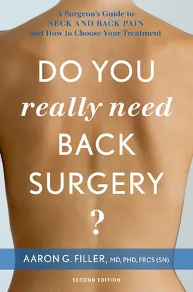 Filler |  Do You Really Need Back Surgery? | Buch |  Sack Fachmedien