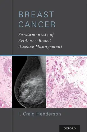 Henderson |  Breast Cancer | Buch |  Sack Fachmedien