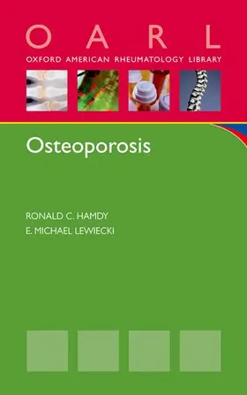 Hamdy / Lewiecki |  Osteoporosis | Buch |  Sack Fachmedien