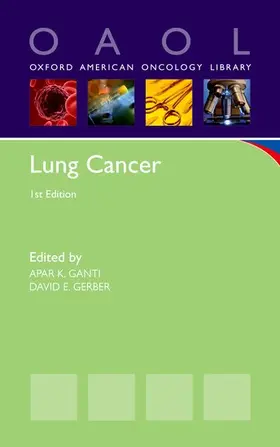 Ganti / Gerber |  Lung Cancer | Buch |  Sack Fachmedien