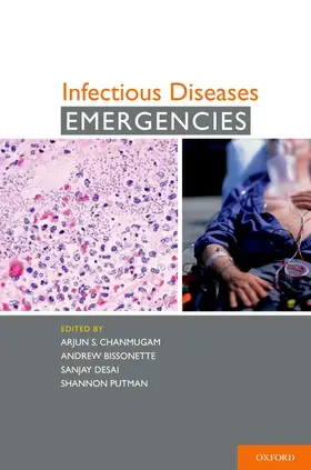 Bissonette / Chanmugam / Rothman |  Infectious Diseases Emergencies | Buch |  Sack Fachmedien