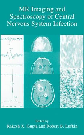 Lufkin / Gupta |  MR Imaging and Spectroscopy of Central Nervous System Infection | Buch |  Sack Fachmedien