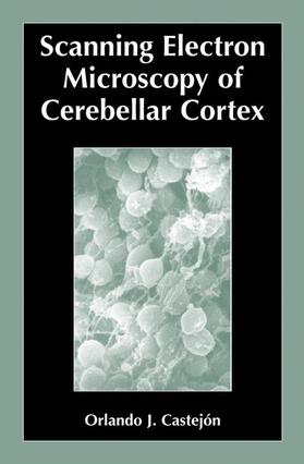 Castejón |  Scanning Electron Microscopy of Cerebellar Cortex | Buch |  Sack Fachmedien