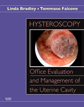 Bradley / Falcone |  Hysteroscopy: Office Evaluation and Management of the Uterine Cavity | Buch |  Sack Fachmedien