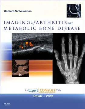 Weissman | Imaging of Arthritis and Metabolic Bone Disease | Buch | 978-0-323-04177-5 | sack.de