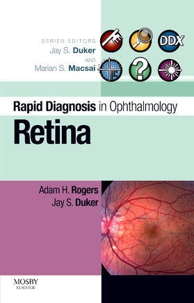 Rogers / Duker |  Retina | Buch |  Sack Fachmedien