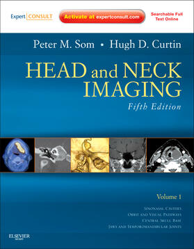 Curtin / Som |  Head and Neck Imaging - 2 Volume Set | Buch |  Sack Fachmedien