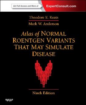 Anderson / Keats |  Atlas of Normal Roentgen Variants That May Simulate Disease | Buch |  Sack Fachmedien