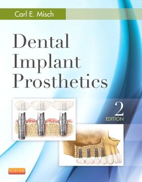 Misch |  Dental Implant Prosthetics | Buch |  Sack Fachmedien
