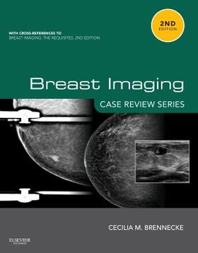 Brennecke |  Breast Imaging: Case Review Series | Buch |  Sack Fachmedien