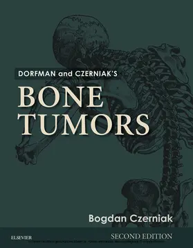 Czerniak |  Dorfman and Czerniak's Bone Tumors E-Book | eBook | Sack Fachmedien