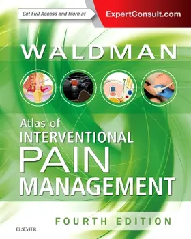 Waldman |  Atlas of Interventional Pain Management | Buch |  Sack Fachmedien